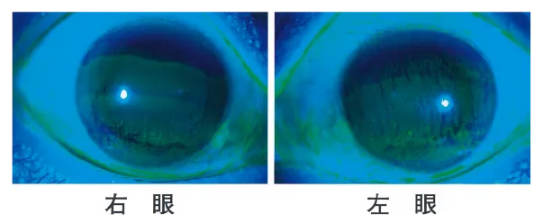 第111回 B問題 第43問の問題画像