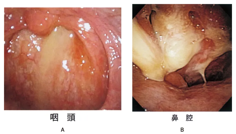 第111回 D問題 第25問の問題画像