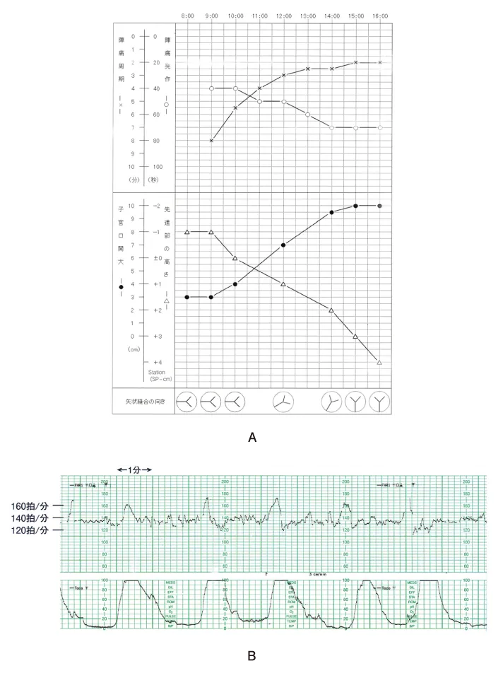 第111回 E問題 第45問の問題画像