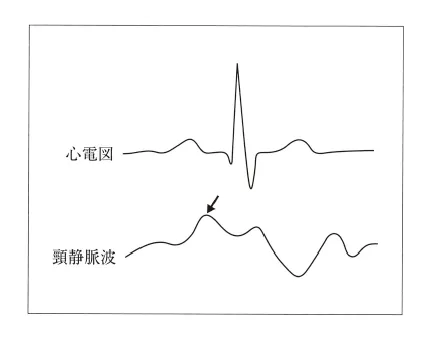 第111回 H問題 第2問の問題画像