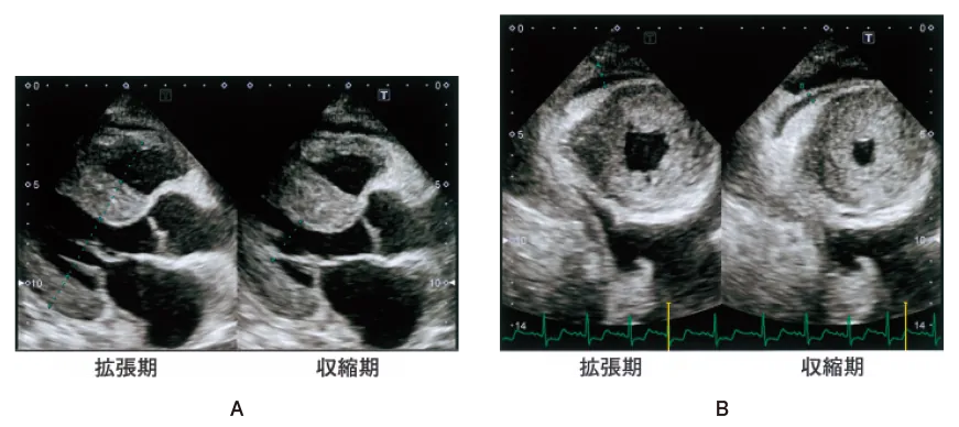 第111回 H問題 第34問の問題画像