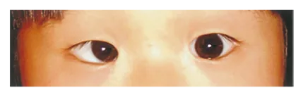 第112回 A問題 第29問の問題画像