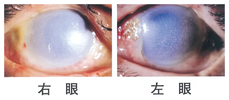 第112回 A問題 第52問の問題画像