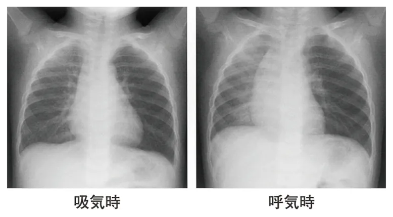 第112回 B問題 第29問の問題画像
