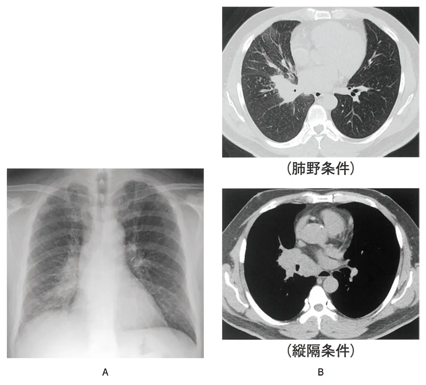 第112回 B問題 第38問の問題画像