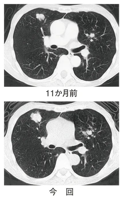 第112回 D問題 第23問の問題画像