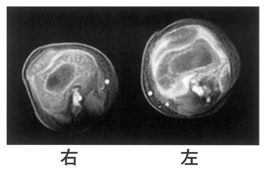 第112回 D問題 第39問の問題画像