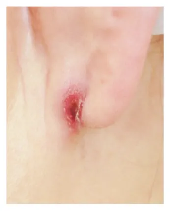 第113回 A問題 第51問の問題画像