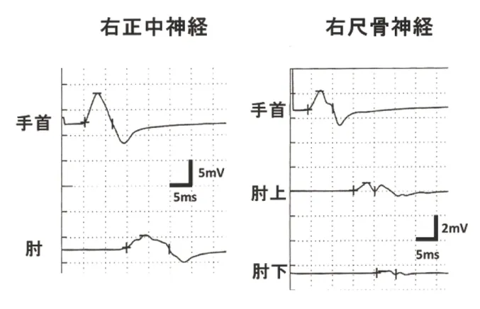 第113回 A問題 第64問の問題画像
