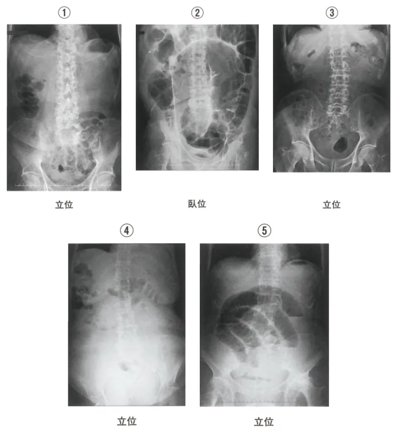 第113回 B問題 第8問の問題画像