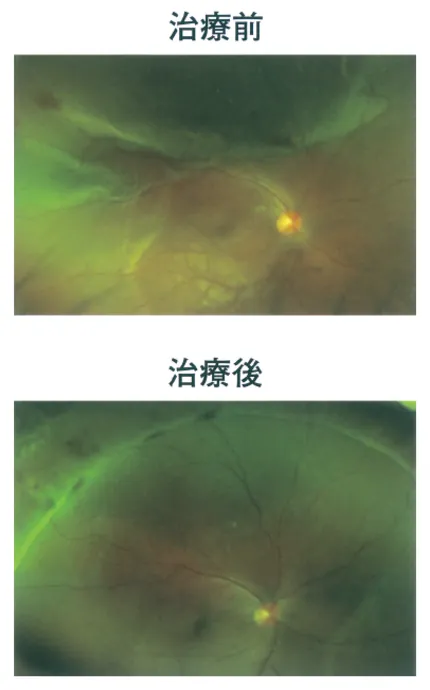 第113回 D問題 第24問の問題画像