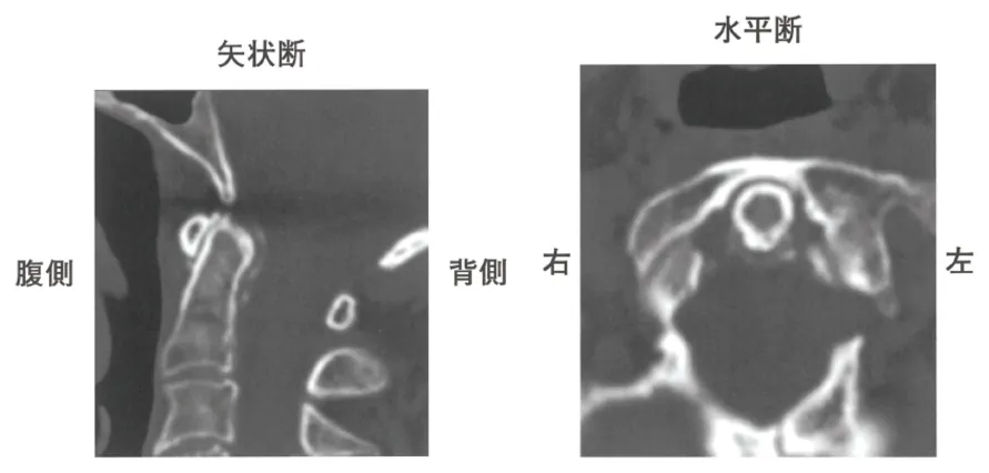第113回 D問題 第40問の問題画像