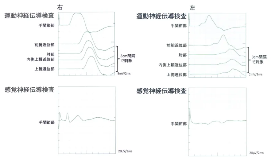 第113回 D問題 第56問の問題画像