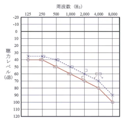 第113回 F問題 第25問の問題画像