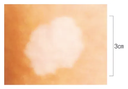 第113回 F問題 第52問の問題画像
