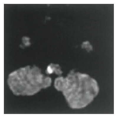 第113回 F問題 第82問の問題画像