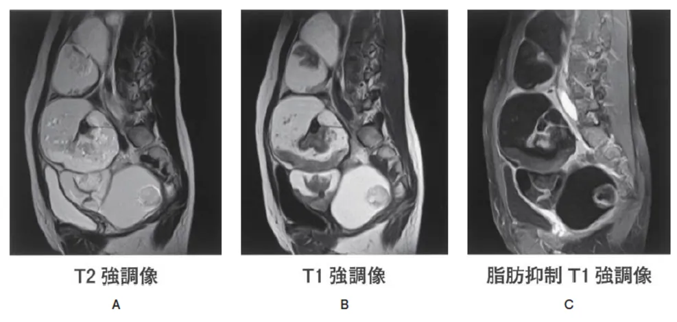 第114回 A問題 第62問の問題画像