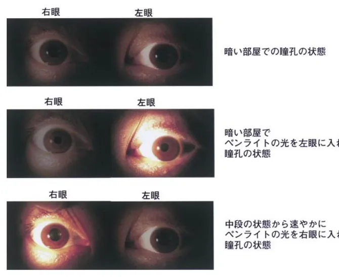 第114回 B問題 第29問の問題画像