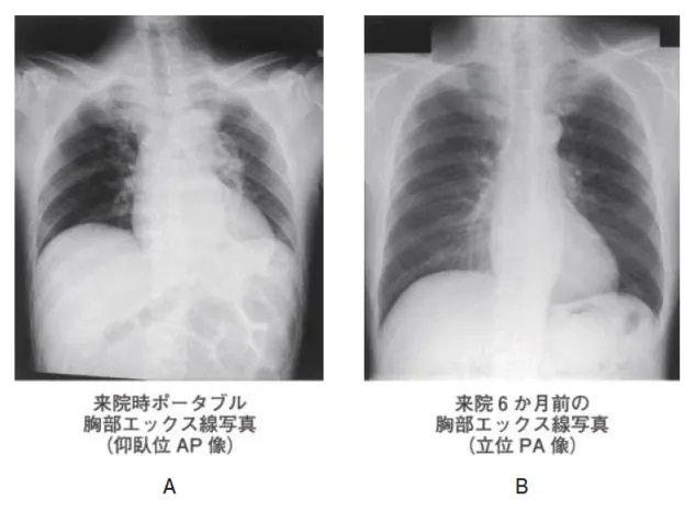 第114回 C問題 第69問の問題画像