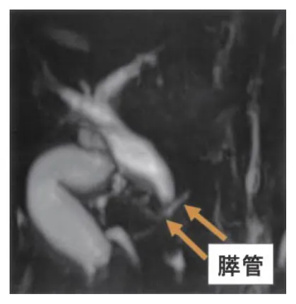 第114回 D問題 第37問の問題画像