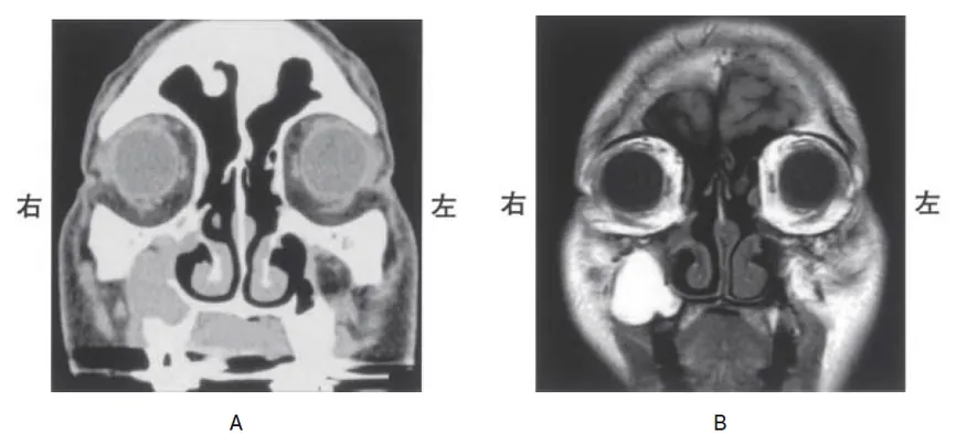 第114回 D問題 第38問の問題画像