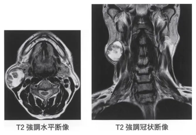 第114回 D問題 第61問の問題画像