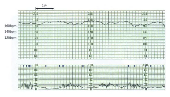 第114回 F問題 第36問の問題画像