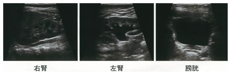 第115回 A問題 第20問の問題画像