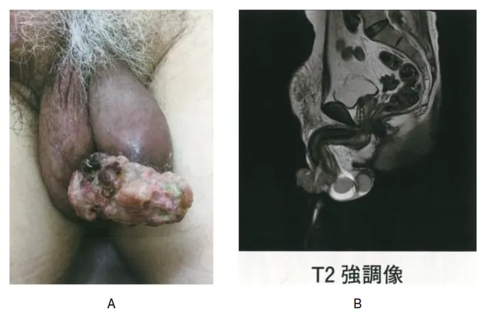 第115回 A問題 第30問の問題画像