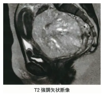 第115回 A問題 第33問の問題画像