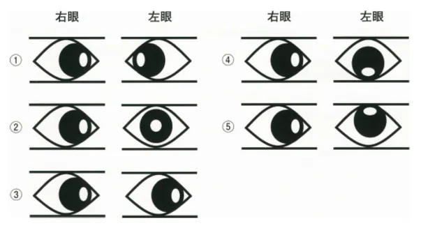 第115回 E問題 第25問の問題画像