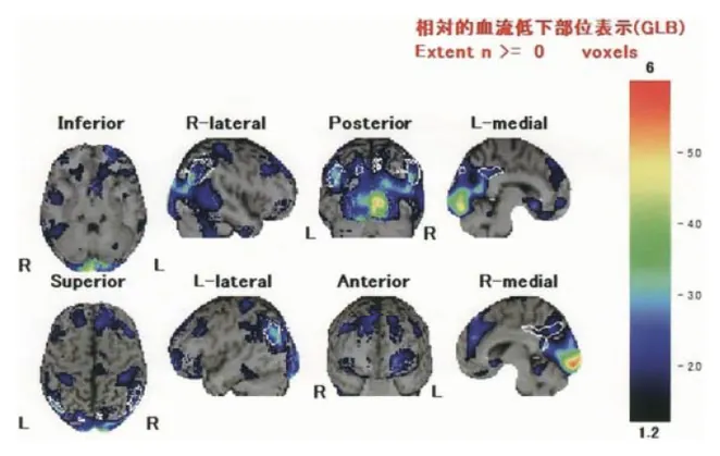 第115回 F問題 第71問の問題画像