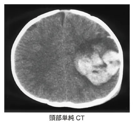 第116回 A問題 第17問の問題画像