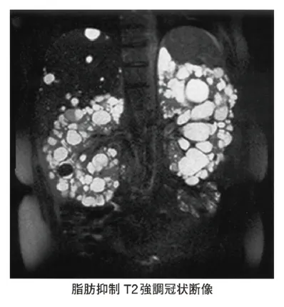 第116回 A問題 第22問の問題画像