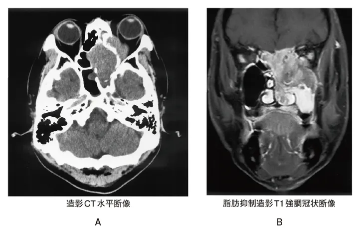 第116回 A問題 第58問の問題画像