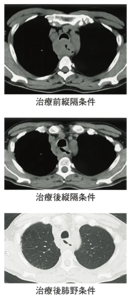 第116回 D問題 第37問の問題画像