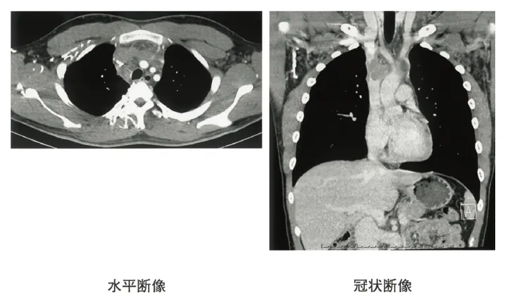 第116回 D問題 第54問の問題画像