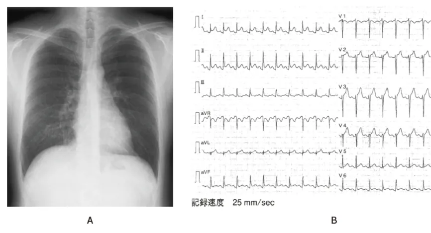第116回 E問題 第38問の問題画像