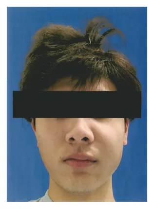 第116回 E問題 第39問の問題画像