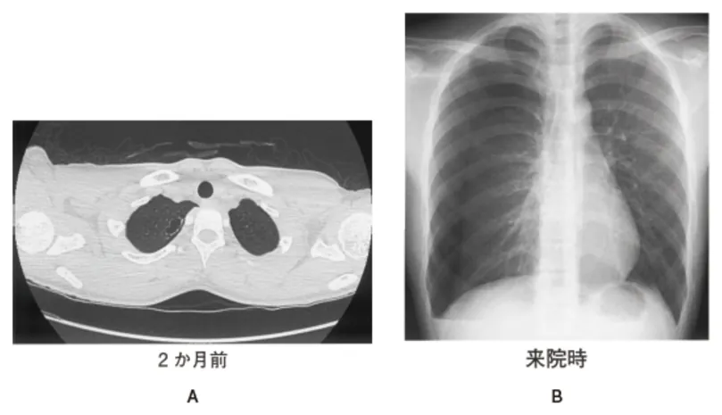 第116回 E問題 第43問の問題画像