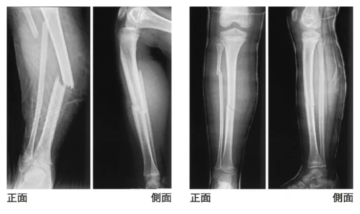 第116回 F問題 第40問の問題画像