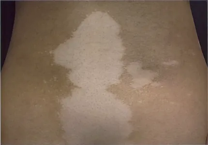 第117回 A問題 第31問の問題画像