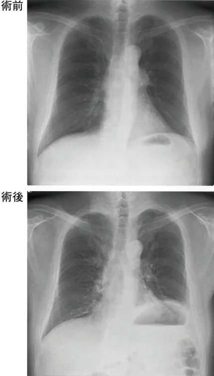 第117回 A問題 第55問の問題画像