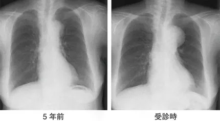 第117回 F問題 第50問の問題画像