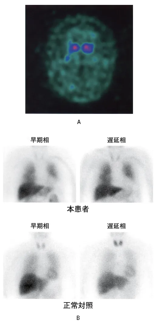 第117回 F問題 第69問の問題画像