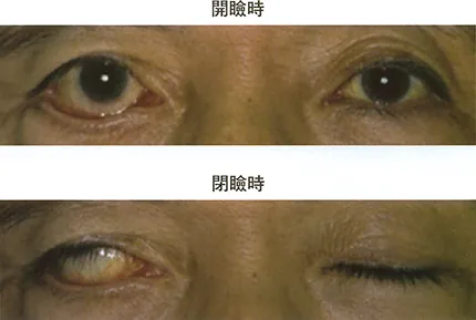 第118回 D問題 第54問の問題画像