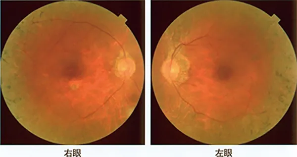 第119回 A問題 第73問の問題画像