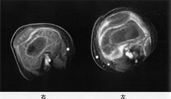 第119回 D問題 第64問の問題画像