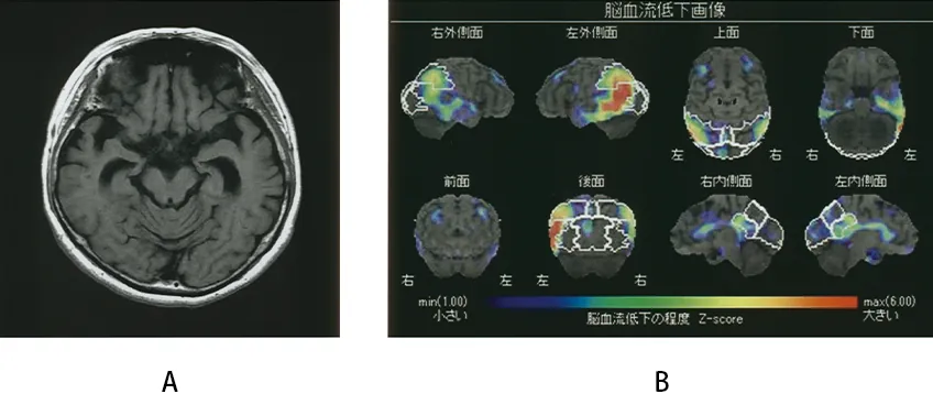 第120回 A問題 第21問の問題画像