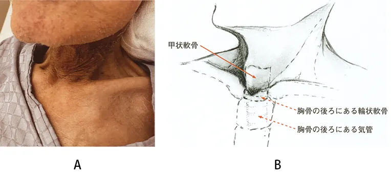 第120回 B問題 第41問の問題画像